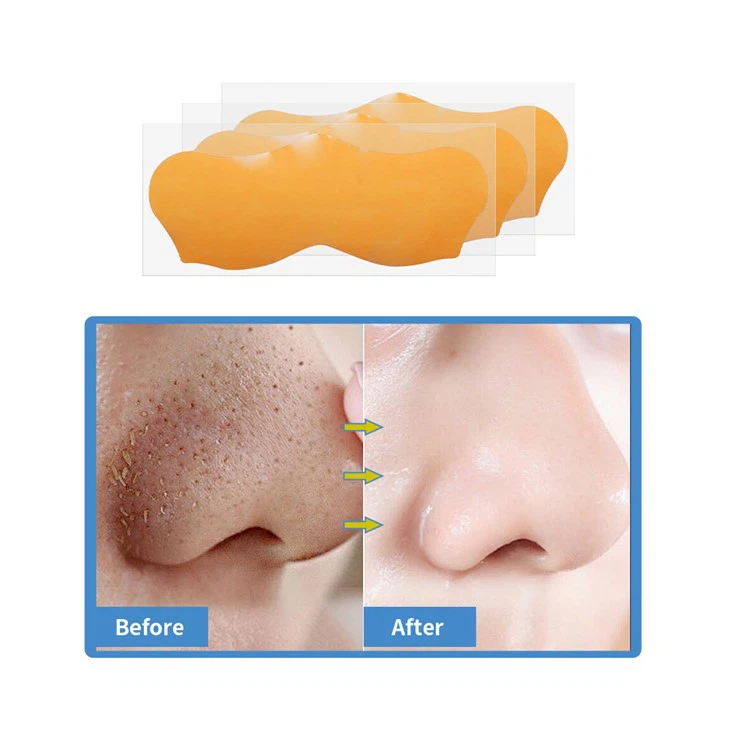 blackhead strips (8)