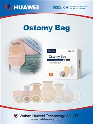 Запор після операції на стомі: повний посібник із безпечного лікування